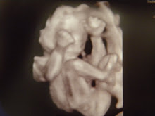 22 Week Ultrasound