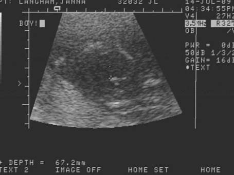 [baby2.bmp]