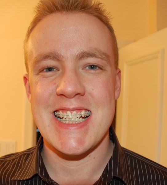 Thrill of the Perfect Grill A Braces & Jaw Surgery Diary Facebook