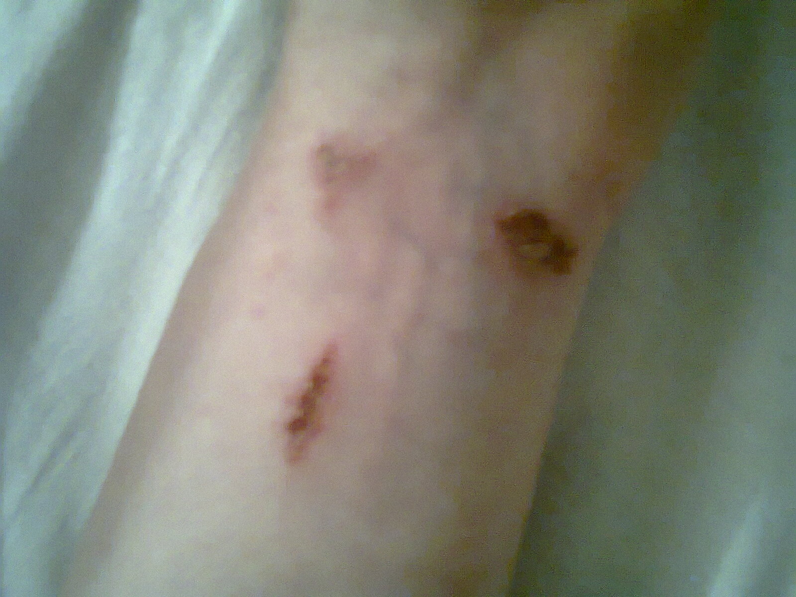 Children Of The Streets Rope Burns