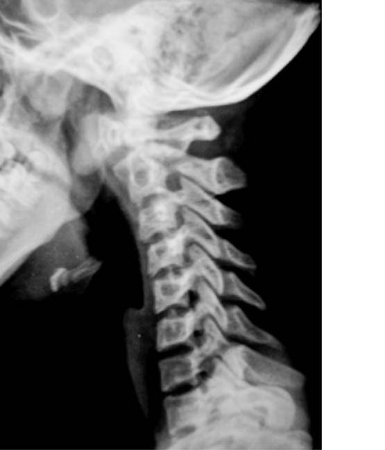 [cuello.bmp]