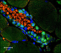 Microvascular Myeloperoxidase