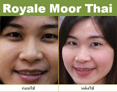 ผู้ใช้ Royale Moor Thai 2