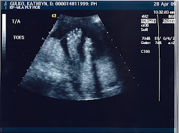 Bella at 23 weeks prepartum