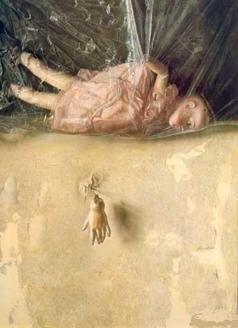 [muñeca-rota-eduardo-naranjo.jpg]