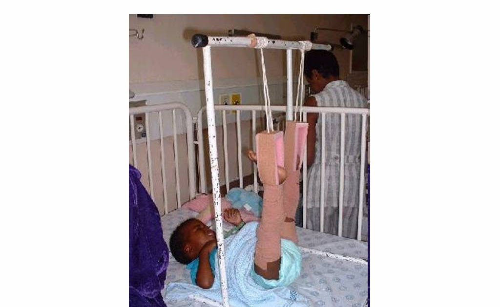 osteo support Gallow's skin traction aids