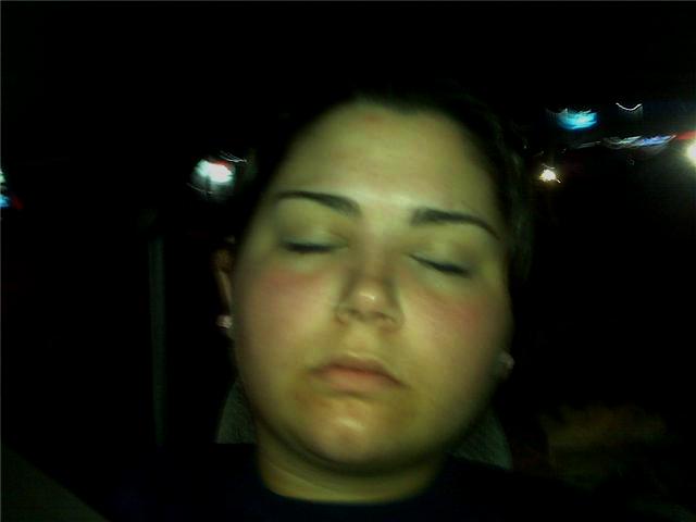 butterfly rash photos