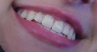 [sorriso.JPG]