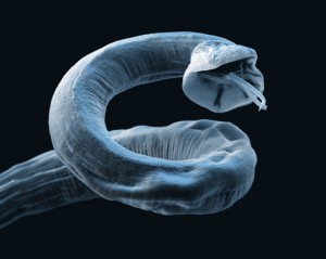 [Lungworm+2-732640.jpg]