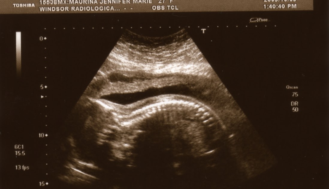 ...and baby makes three! 24 week ultrasound