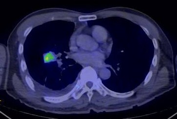 NeXRadiology - making Radiology interesting!