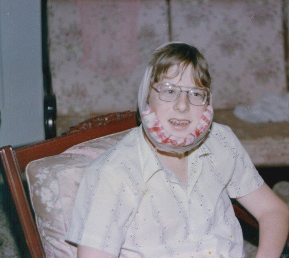[1984-wisdom-teeth.JPG]