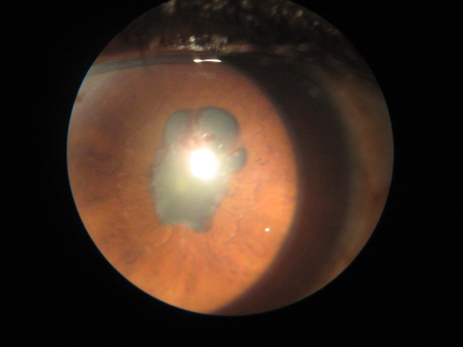 Pictures Take Care Of Your Eyes