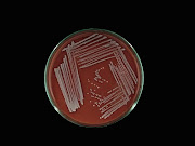 S. aureus in Chocolate Agar