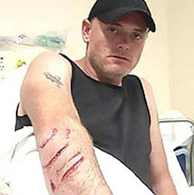 Now That S Nifty Shark Bite Victims