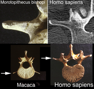 [morotopithecus-human-vertebrae.jpg]