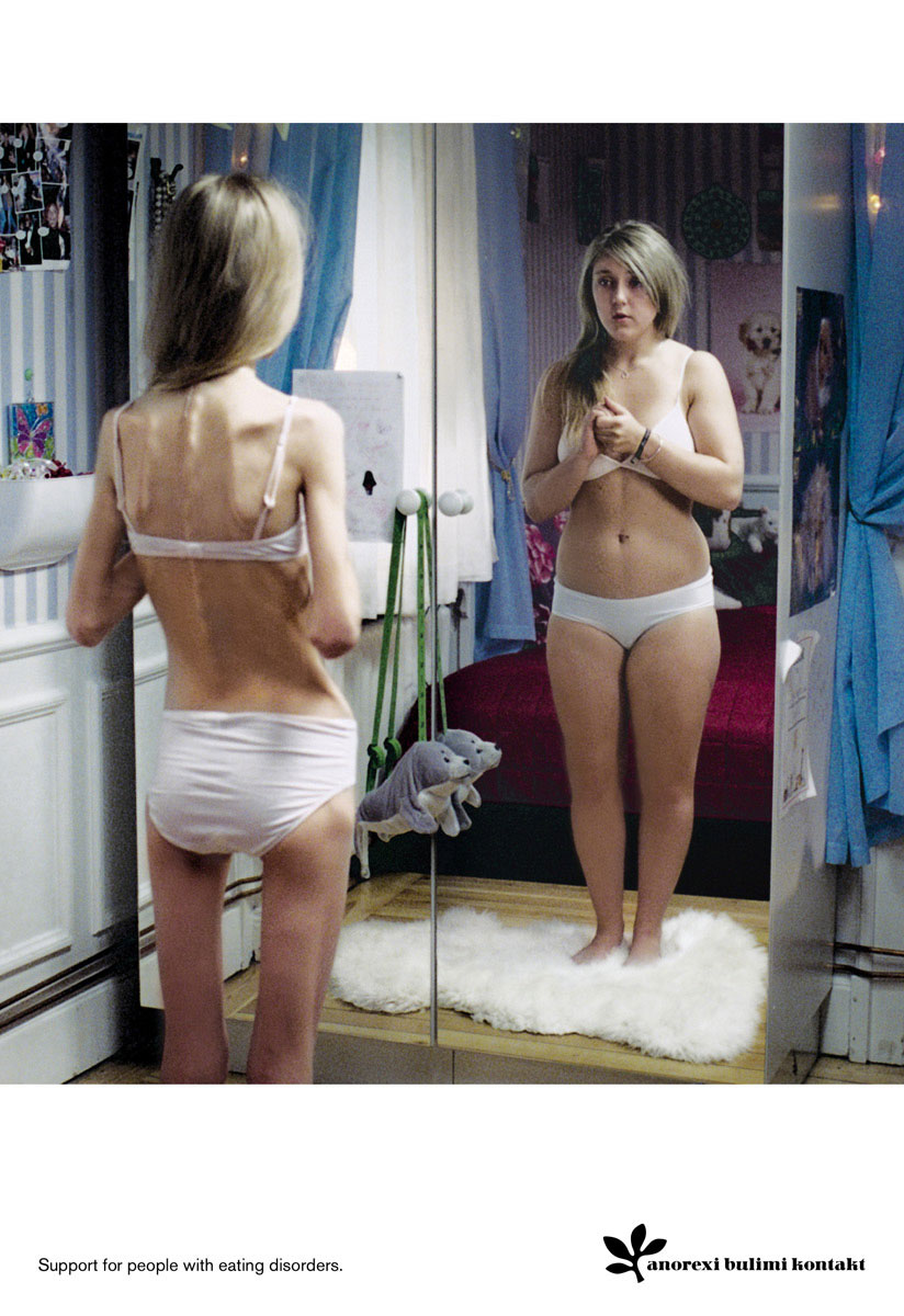 Anorexia Blog