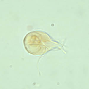 Les noms des parasites chez la personne