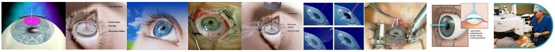 Is LASIK Surgery Right For Me - Free of Cost Treatment Services