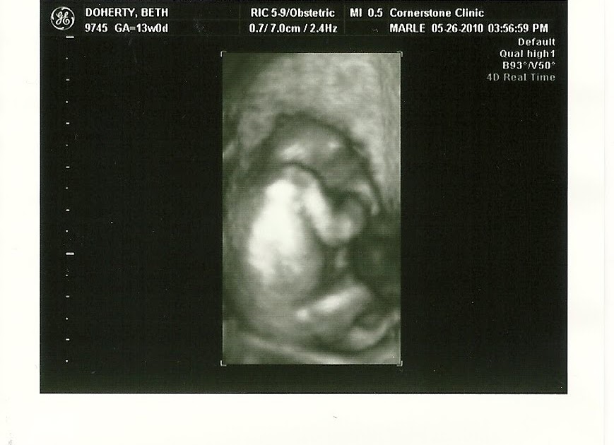 The Doherty Dish Baby at 13 Weeks