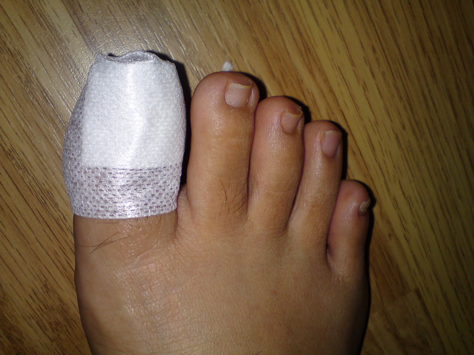 Special Love, Joy & Passion! Day 16 of Hols Changing of Toe Wound