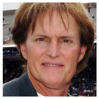 Plastic Surgery Before After: Bruce Jenner Plastic Surgery