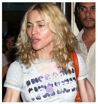Madonna Plastic Surgery on Madonna Plastic Surgery   Karmal Health