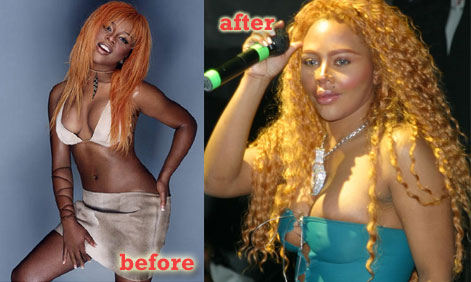 Lil Kim Before After. Lil Kim has had a ridiculous amount of plastic surgery 