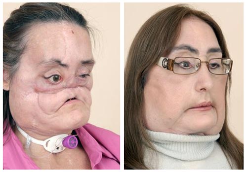 [ConnieCulpBeforeAfter.jpg]