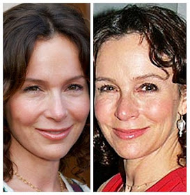 Plastic Surgery Before And After: Jennifer Grey Before And After Nose Job