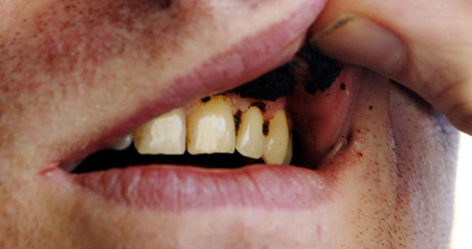 under the snus category,