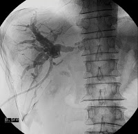 Cholangiogram