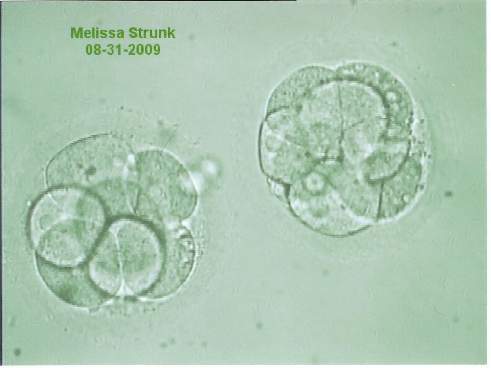 [Embryo+Pic.jpg]