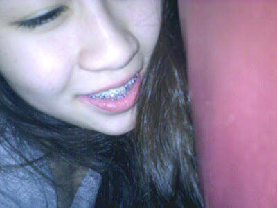 you can see the colour of my braces. 