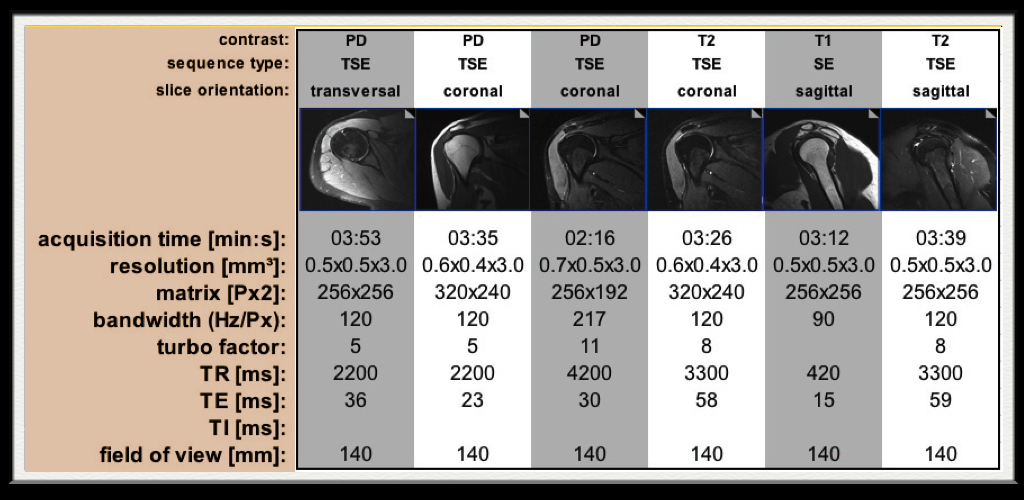 Shoulder MRI
