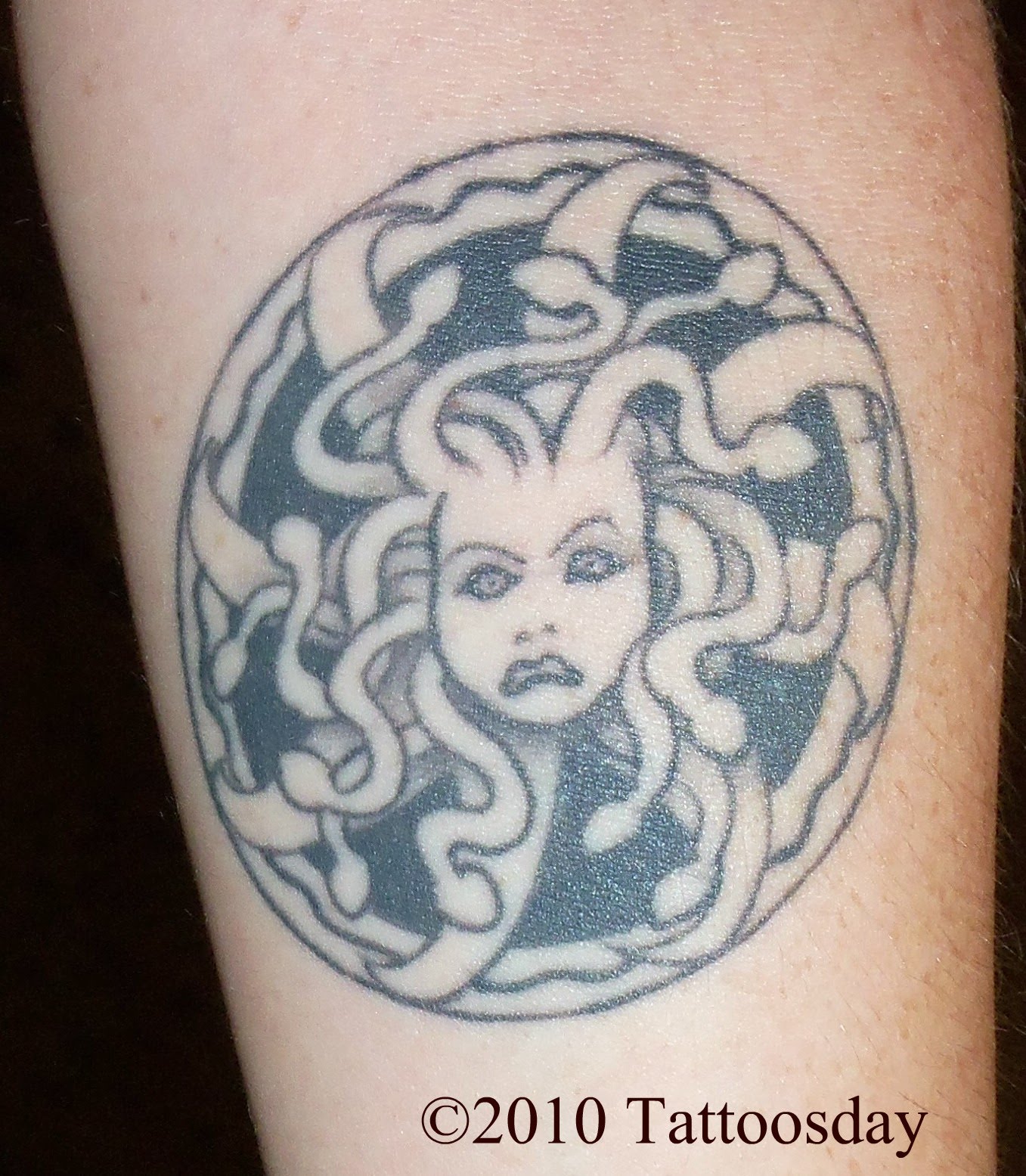 Medusa+before+and+after