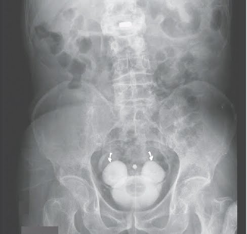 Natural Cures For Urinary Infection In Dogs Natural Cures For Urinary Infection In Dogs