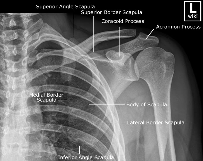 Doctors Gates Anatomy on Radiographic Scapula