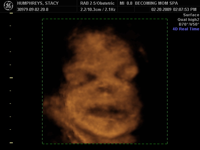 [BABY_6.JPG]