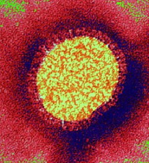 Le virus de la grippe A (H1N1)