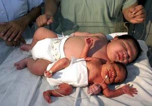 simply jews the 19 pound baby not largest baby ever born
