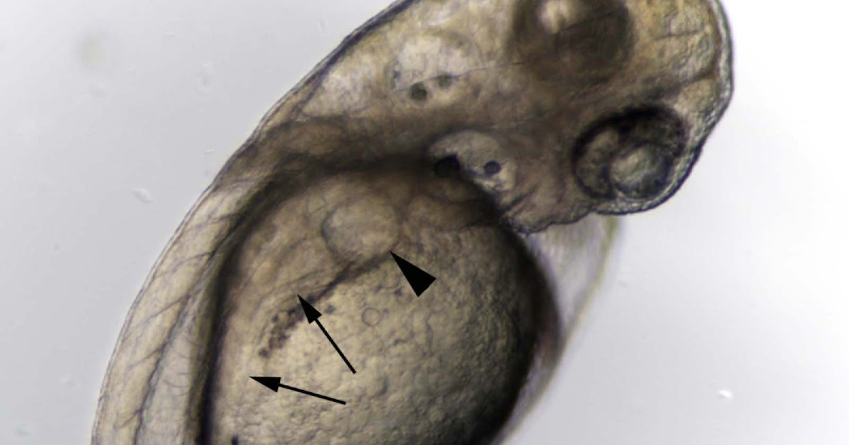 Renal Fellow Network: Zebrafish Model of Cystic Kidney Disease