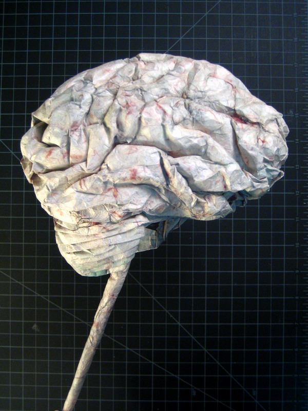 [brain1.jpg]