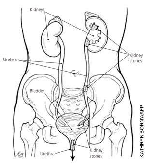 Frojon: Kidney Special