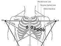 Ecg Leads Diagram Ecg Leads Diagram