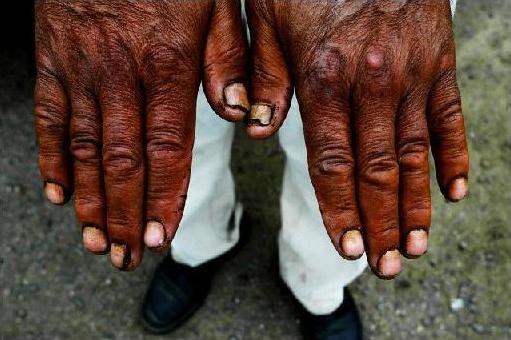 [awadi+hands.JPG]