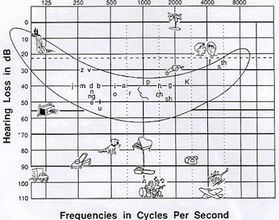 Hearing Banana Chart