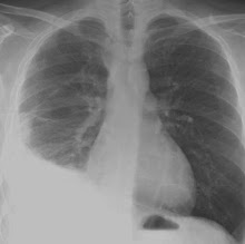 RX PULMONAR