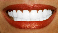rouge à lèvres et dents blanches