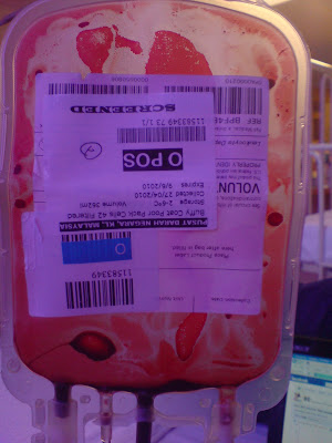 thalassaemia blood transfusion